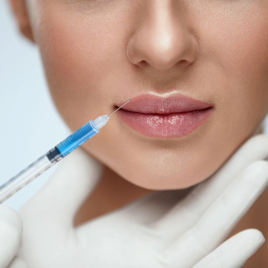 Filler für zarte Lippen: juvederm volbella bei MorySkin entdecken