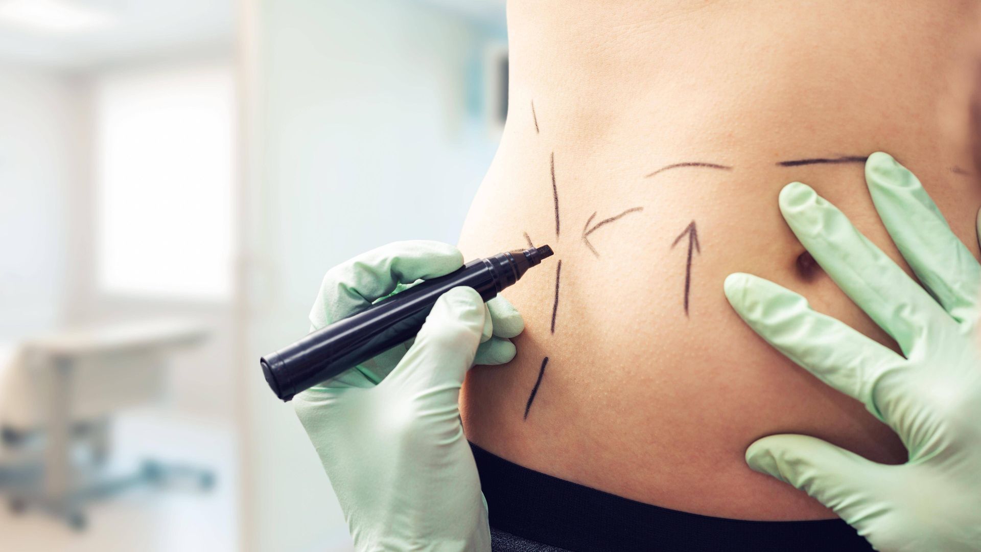 Ihre beste Wahl für langfristige Ergebnisse – Magenverkleinerung Türkei Beste klinik